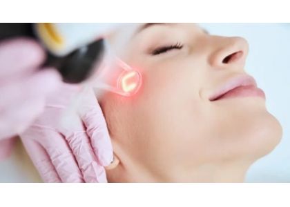 A Comprehensive Guide to Fractional CO2 Laser Treatment