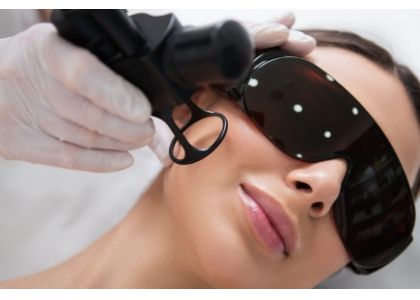 Reclaiming Your Skin's Glow: CO2 Fractional Laser for Hyperpigmentation
