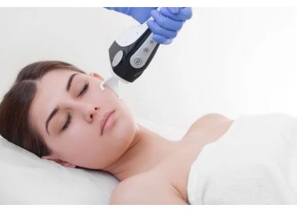 CO2 Fractional Laser for Acne Scars: A Comprehensive Guide to Clearer Skin